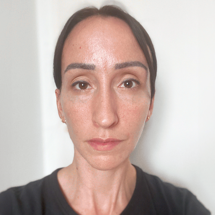 Tanja Resultate Skin Clear Adult ölige Haut Pickel