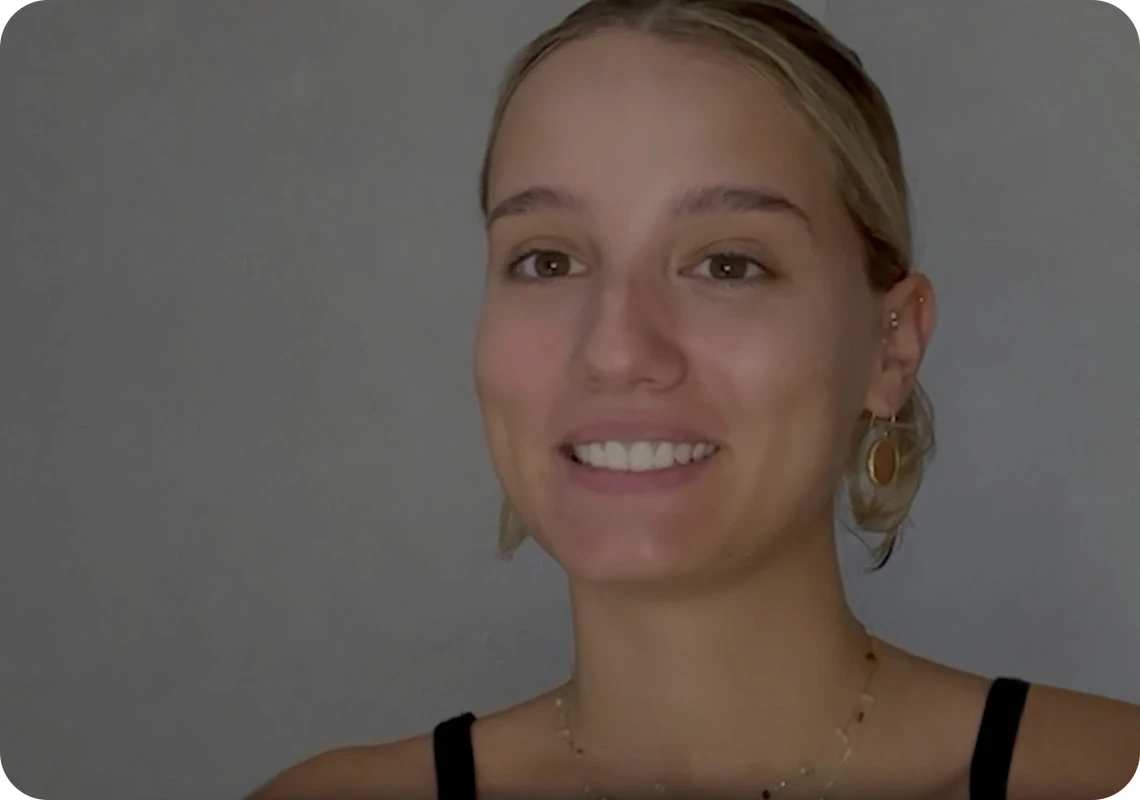 Amanda Video Feedback Care Filabe Acne Pimples recommend