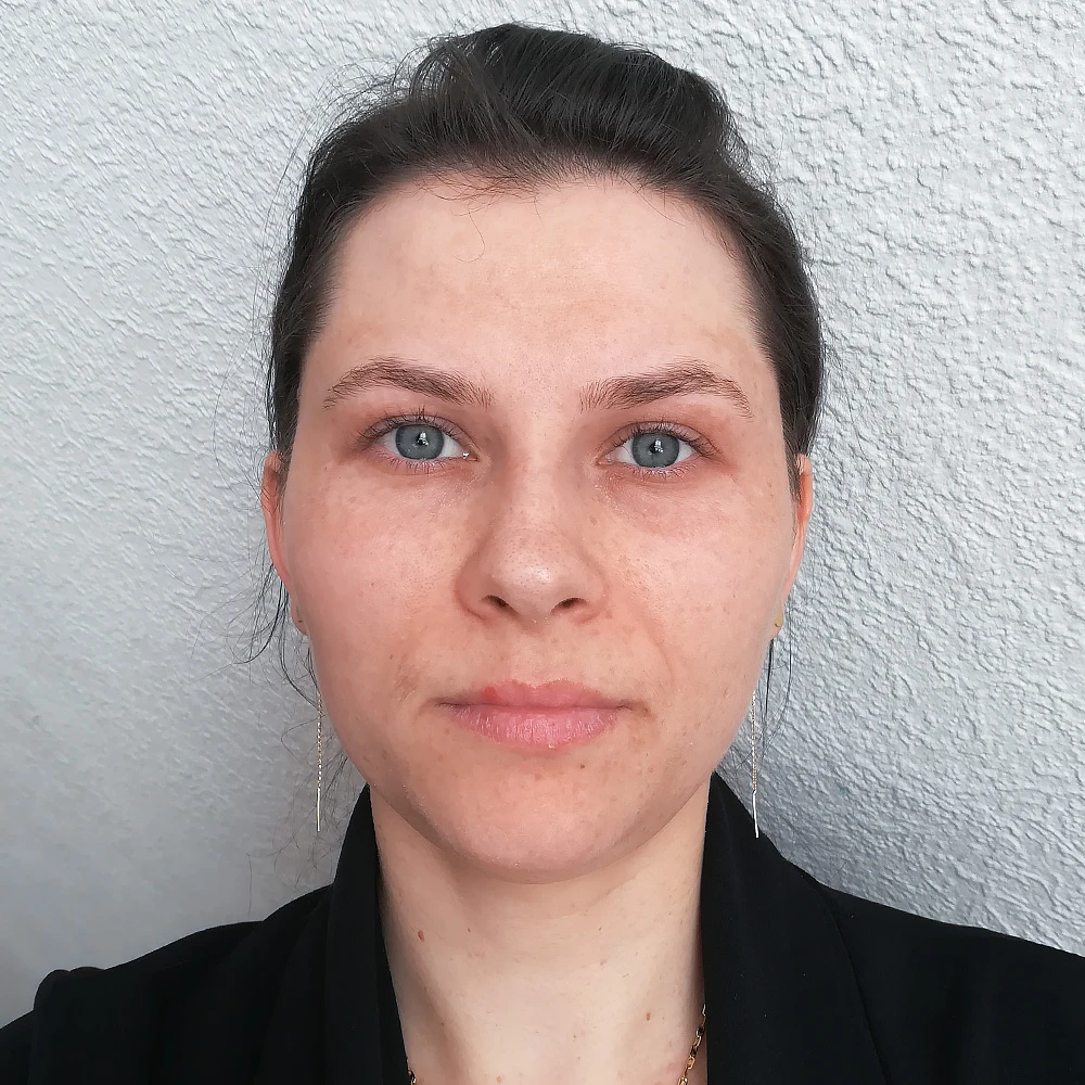 Cristina Behandlung Pigmentflecken Altersflecken before