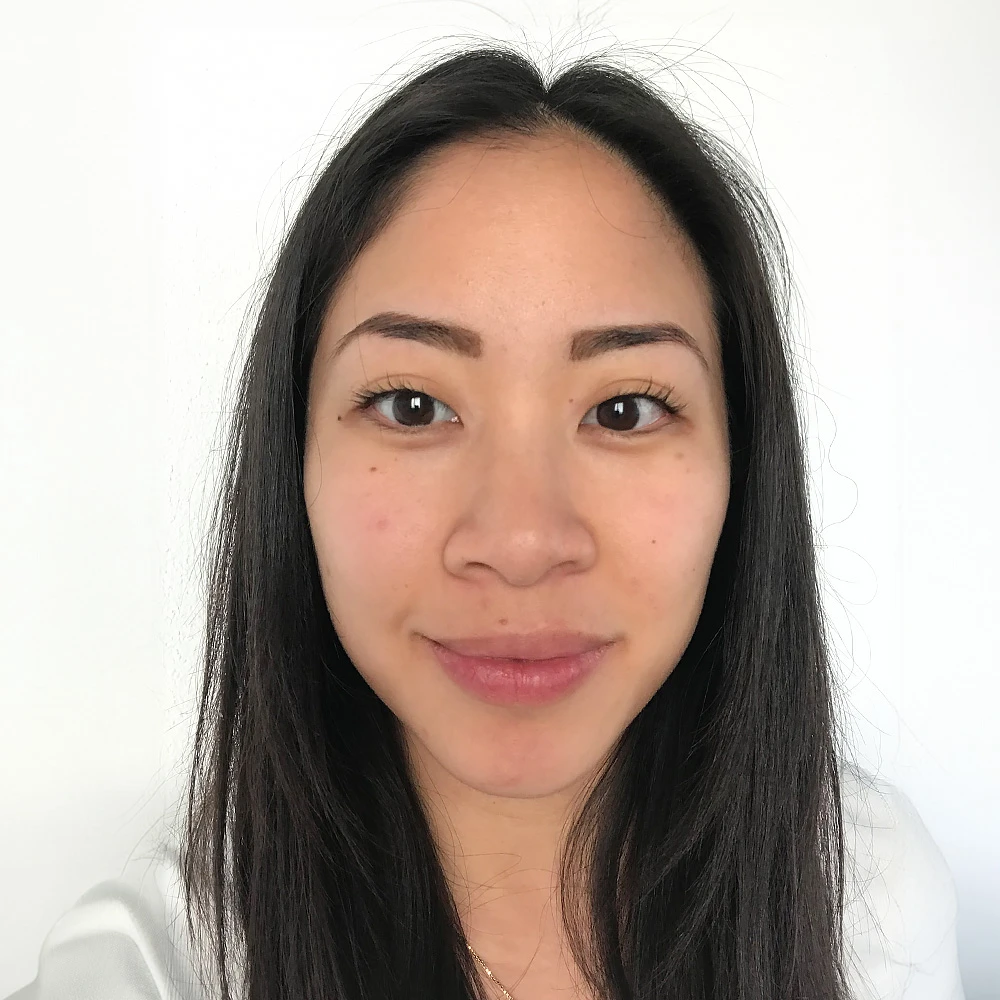 Pigmentstörungen Behandlung Pigmentflecken Altersflecken Resultate vorher nachher after