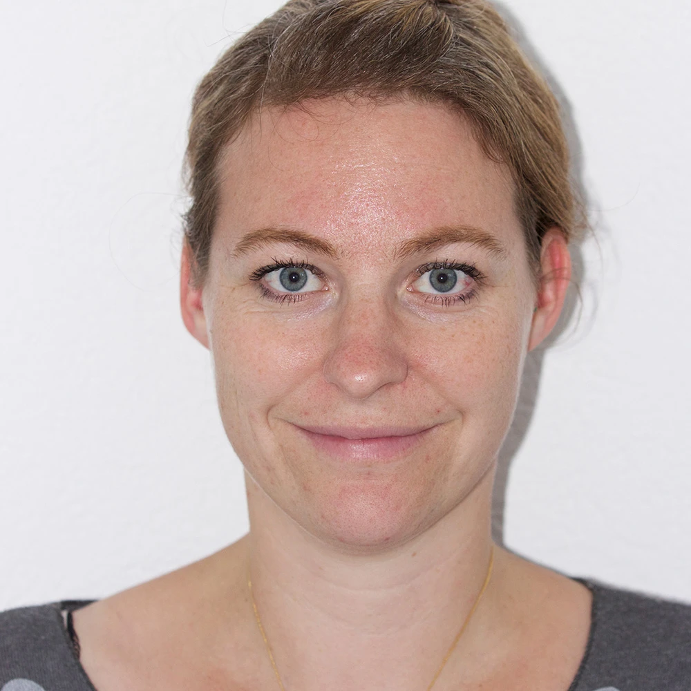 Andrea Pigmentstörungen Behandlung Pigmentflecken Altersflecken after