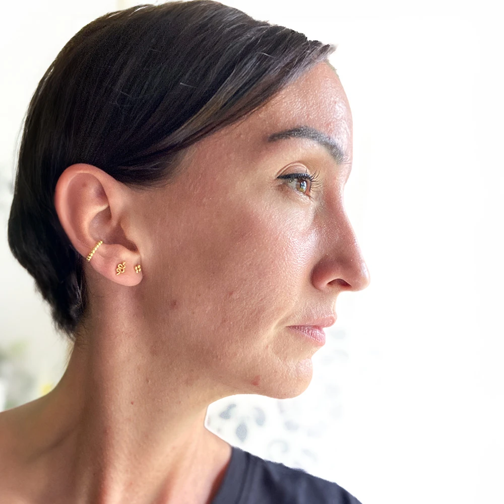 Tanja Resultate Skin Clear Adult ölige Haut Pickel After